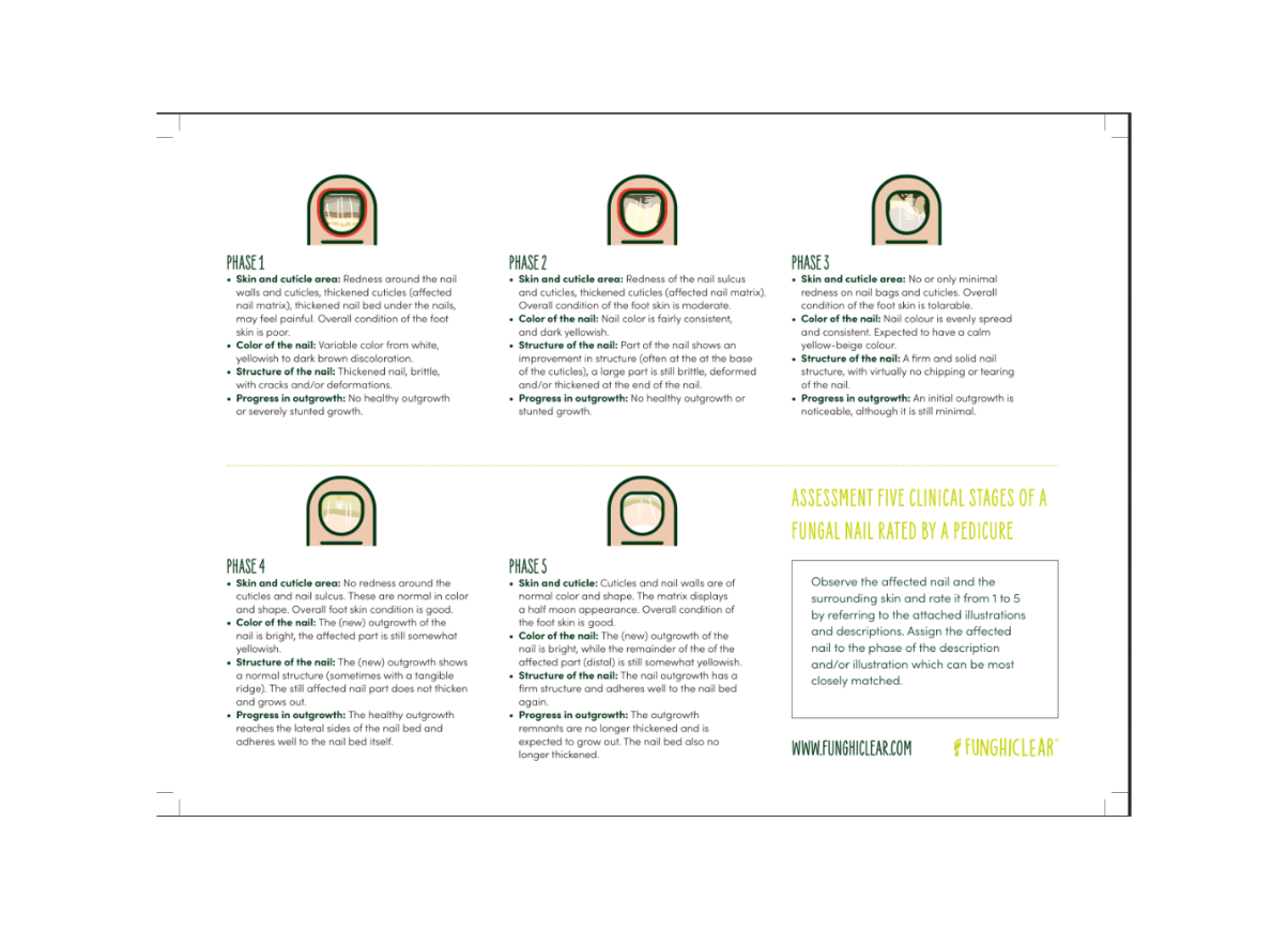 Infographic used by footcare professionals to inform five stages of Toenail Rating